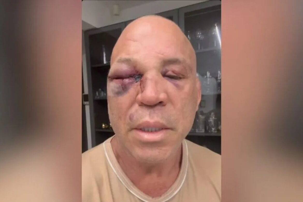 wanderlei-silva-diz-que-vai-a-justica-apos-pancadaria-em-luta-contra-popo