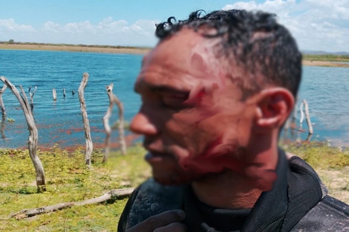homem-sobrevive-apos-ataque-de-jacare-em-rio-de-cidade-do-interior-da-bahia